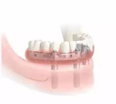 Çin Dental Diş Fuarı Çince Tercüman